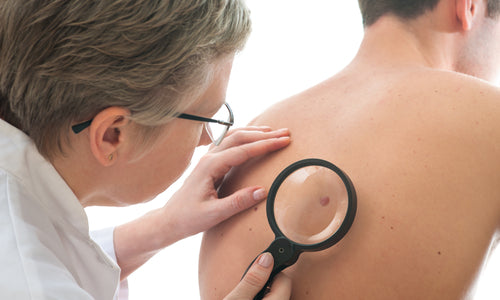 dermatologist examines mole