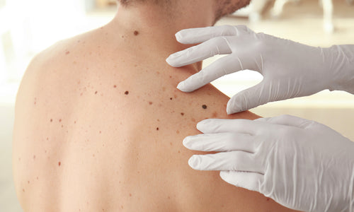 dermatologist examining patient's back