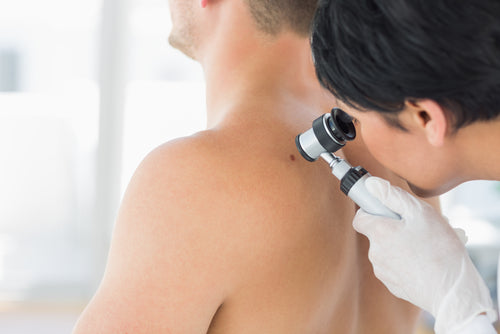 doctor examining mole on back