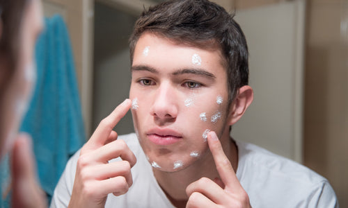 man applying acne creme