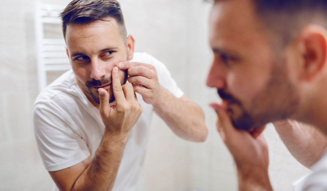 man squeezing zit on face